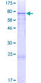 CYP27 / CYP27A1 Protein - 12.5% SDS-PAGE of human CYP27A1 stained with Coomassie Blue