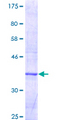 CYP27B1 Protein - 12.5% SDS-PAGE Stained with Coomassie Blue.