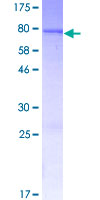 CYP2A13 Protein - 12.5% SDS-PAGE of human CYP2A13 stained with Coomassie Blue