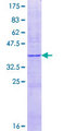 CYP2A13 Protein - 12.5% SDS-PAGE Stained with Coomassie Blue.