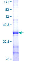 CYP2A6 Protein - 12.5% SDS-PAGE Stained with Coomassie Blue.
