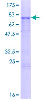 CYP2A7 Protein - 12.5% SDS-PAGE of human CYP2A7 stained with Coomassie Blue
