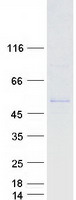 CYP2A7 Protein - Purified recombinant protein CYP2A7 was analyzed by SDS-PAGE gel and Coomassie Blue Staining
