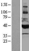 CYP2B6 Protein - Western validation with an anti-DDK antibody * L: Control HEK293 lysate R: Over-expression lysate
