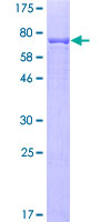 CYP2B6 Protein - 12.5% SDS-PAGE of human CYP2B6 stained with Coomassie Blue