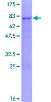 CYP2C18 / CYP2C Protein - 12.5% SDS-PAGE of human CYP2C18 stained with Coomassie Blue