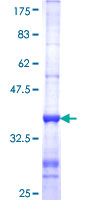 CYP2C18 / CYP2C Protein - 12.5% SDS-PAGE Stained with Coomassie Blue.