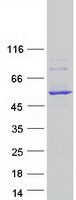 CYP2C18 / CYP2C Protein - Purified recombinant protein CYP2C18 was analyzed by SDS-PAGE gel and Coomassie Blue Staining