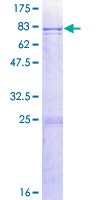 CYP2C8 Protein - 12.5% SDS-PAGE of human CYP2C8 stained with Coomassie Blue