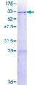 CYP2C8 Protein - 12.5% SDS-PAGE of human CYP2C8 stained with Coomassie Blue