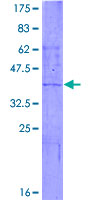 CYP2C9 / Cytochrome P450 2C9 Protein - 12.5% SDS-PAGE of human CYP2C9 stained with Coomassie Blue