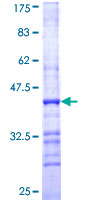 CYP2D6 Protein - 12.5% SDS-PAGE Stained with Coomassie Blue.