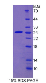 CYP2D6 Protein - Recombinant Cytochrome P450 2D6 By SDS-PAGE