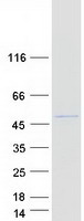 CYP2D6 Protein - Purified recombinant protein CYP2D6 was analyzed by SDS-PAGE gel and Coomassie Blue Staining
