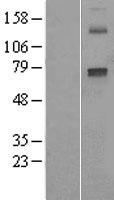 CYP2E1 Protein - Western validation with an anti-DDK antibody * L: Control HEK293 lysate R: Over-expression lysate