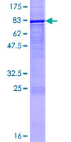 CYP2E1 Protein - 12.5% SDS-PAGE of human CYP2E1 stained with Coomassie Blue