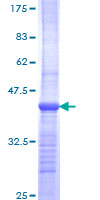 CYP2E1 Protein - 12.5% SDS-PAGE Stained with Coomassie Blue.