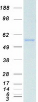 CYP2E1 Protein - Purified recombinant protein CYP2E1 was analyzed by SDS-PAGE gel and Coomassie Blue Staining