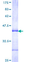 CYP2J2 Protein - 12.5% SDS-PAGE Stained with Coomassie Blue.
