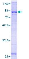 CYP2W1 Protein - 12.5% SDS-PAGE of human CYP2W1 stained with Coomassie Blue