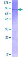 CYP39A1 Protein - 12.5% SDS-PAGE of human CYP39A1 stained with Coomassie Blue