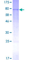 CYP3A4 / Cytochrome P450 3A4 Protein - 12.5% SDS-PAGE of human CYP3A4 stained with Coomassie Blue