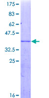 CYP3A4 / Cytochrome P450 3A4 Protein - 12.5% SDS-PAGE Stained with Coomassie Blue.