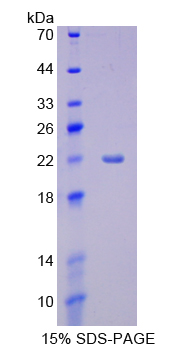 CYP3A4 / Cytochrome P450 3A4 Protein - Recombinant  Cytochrome P450 3A4 By SDS-PAGE
