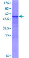 CYP3A43 Protein - 12.5% SDS-PAGE of human CYP3A43 stained with Coomassie Blue