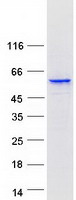 CYP3A5 Protein - Purified recombinant protein CYP3A5 was analyzed by SDS-PAGE gel and Coomassie Blue Staining