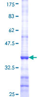 CYP3A7 Protein - 12.5% SDS-PAGE Stained with Coomassie Blue.