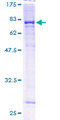 CYP4F11 Protein - 12.5% SDS-PAGE of human CYP4F11 stained with Coomassie Blue