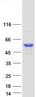 CYP4F11 Protein - Purified recombinant protein CYP4F11 was analyzed by SDS-PAGE gel and Coomassie Blue Staining