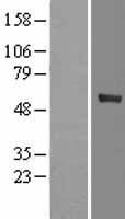 CYP4F12 Protein - Western validation with an anti-DDK antibody * L: Control HEK293 lysate R: Over-expression lysate