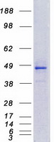 CYP4F12 Protein - Purified recombinant protein CYP4F12 was analyzed by SDS-PAGE gel and Coomassie Blue Staining