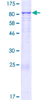 CYP4F22 Protein - 12.5% SDS-PAGE of human CYP4F22 stained with Coomassie Blue