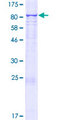 CYP4F22 Protein - 12.5% SDS-PAGE of human CYP4F22 stained with Coomassie Blue