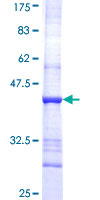 CYP51A1 / CYP51 Protein - 12.5% SDS-PAGE Stained with Coomassie Blue.