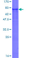 CYP7B1 Protein - 12.5% SDS-PAGE of human CYP7B1 stained with Coomassie Blue