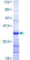 CYP7B1 Protein - 12.5% SDS-PAGE Stained with Coomassie Blue.