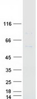 CYP7B1 Protein - Purified recombinant protein CYP7B1 was analyzed by SDS-PAGE gel and Coomassie Blue Staining