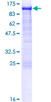 CYPOR / POR Protein - 12.5% SDS-PAGE of human POR stained with Coomassie Blue
