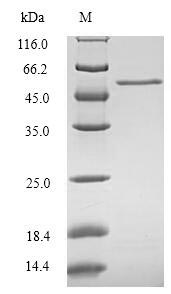 CYR61 Protein - (Tris-Glycine gel) Discontinuous SDS-PAGE (reduced) with 5% enrichment gel and 15% separation gel.