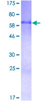 CYR61 Protein - 12.5% SDS-PAGE of human CYR61 stained with Coomassie Blue