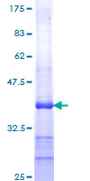 CYR61 Protein - 12.5% SDS-PAGE Stained with Coomassie Blue.