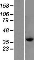 CYSLT2 / CYSLTR2 Protein - Western validation with an anti-DDK antibody * L: Control HEK293 lysate R: Over-expression lysate