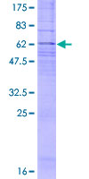 CYSLTR1 / CYSLT1 Protein - 12.5% SDS-PAGE of human CYSLTR1 stained with Coomassie Blue