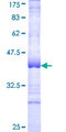 CYSLTR1 / CYSLT1 Protein - 12.5% SDS-PAGE Stained with Coomassie Blue.