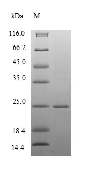 CYSRT1 / C9orf169 Protein - (Tris-Glycine gel) Discontinuous SDS-PAGE (reduced) with 5% enrichment gel and 15% separation gel.