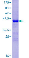 CYSRT1 / C9orf169 Protein - 12.5% SDS-PAGE of human MGC59937 stained with Coomassie Blue